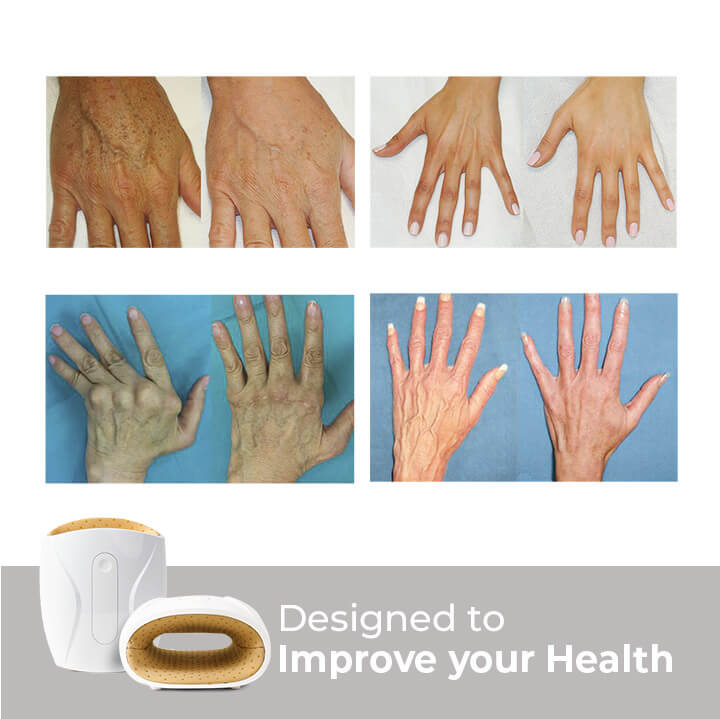 Pain Free UK™ Hand Massager - Quick Relief for Hand Pain in Just 15 Minutes a Day*